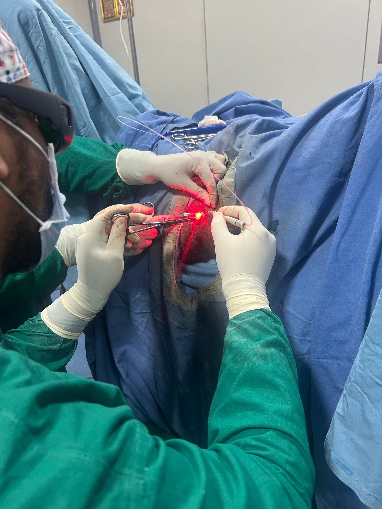 Laser Proctology Equipment